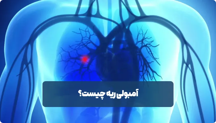 آمبولی ریه چگونه ایجاد می‌شود