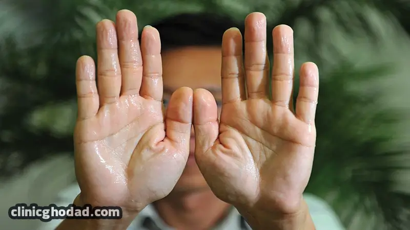 تشخیص عرق کردن کف دست