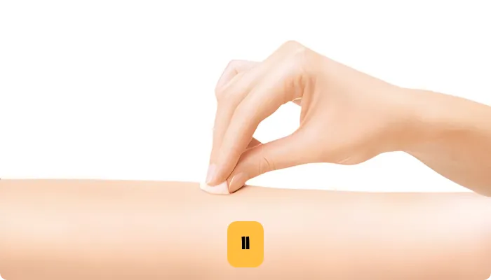 مرحله دوم تزریق روی پوست